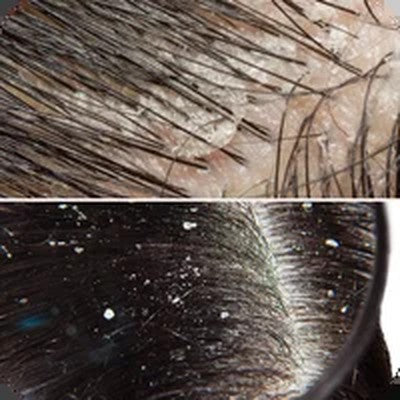 Scalp Problems